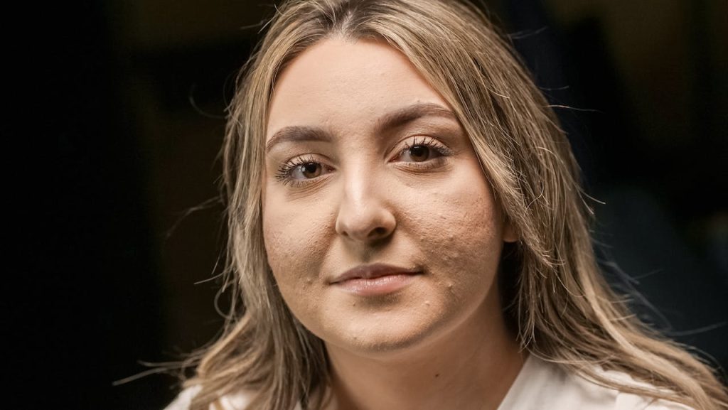Secrete ale luptei cu acneea