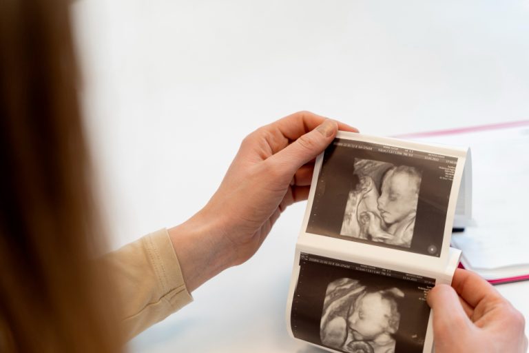 Morfologia fetală din trimestrul 1: de ce este primul control atât de important?